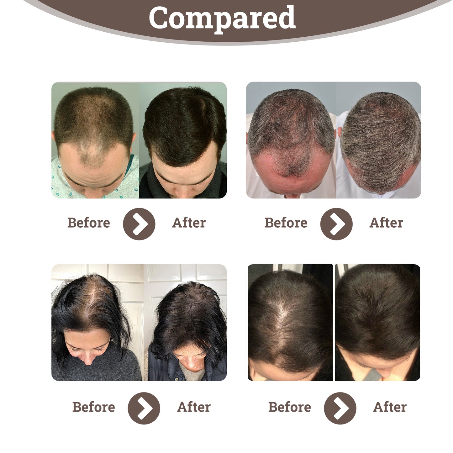 Hair Enhancement Spray Anti-Loss Hair Enhancement Repair Strong And Dense Hair Treatment Spray