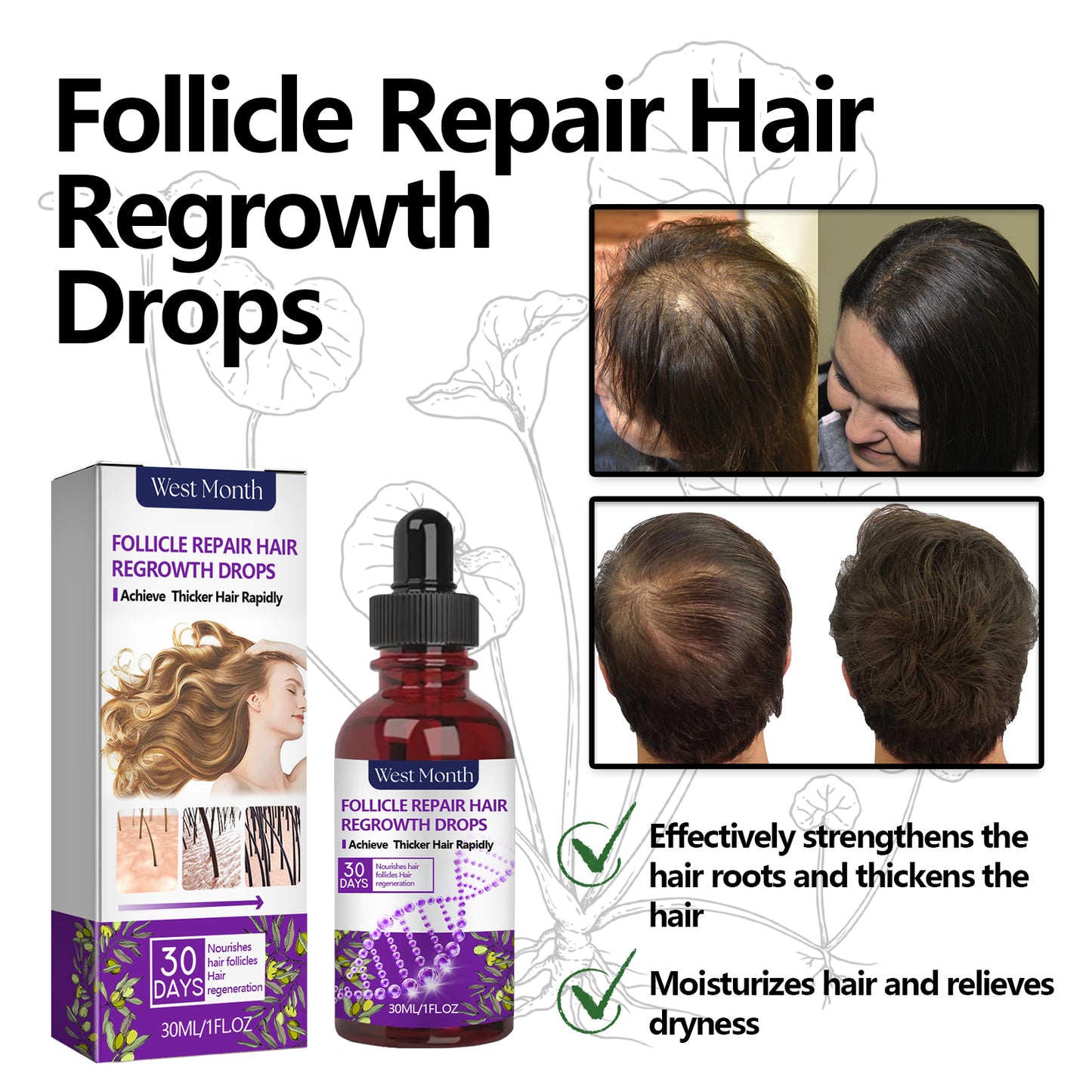 Follicle Repair Hair Regrowth Drops, Hair Protection Strong And Solid Hair Thickening Scalp Nourishing Massage Lotion